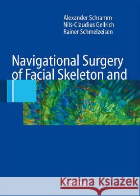 Navigational Surgery of the Facial Skeleton A. Schramm N. -C Gellrich R. Schmelzeisen 9783540223573 Springer - książka