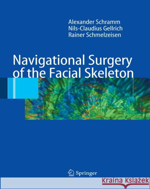 Navigational Surgery of the Facial Skeleton Alexander Schramm Nils-Claudius Gellrich Rainer Schmelzeisen 9783662517642 Springer - książka