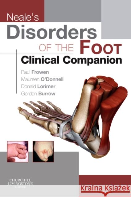 Neale's Disorders of the Foot Clinical Companion Paul Frowen 9780702031717 Elsevier Health Sciences - książka