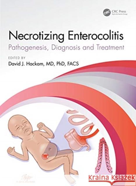 Necrotizing Enterocolitis: Pathogenesis, Diagnosis and Treatment David J. Hackam 9781138343245 CRC Press - książka