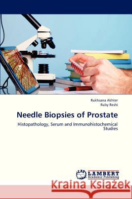 Needle Biopsies of Prostate Akhter Rukhsana, Reshi Ruby 9783659333965 LAP Lambert Academic Publishing - książka