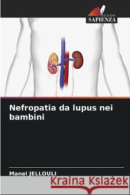 Nefropatia da lupus nei bambini Manel Jellouli 9786205870860 Edizioni Sapienza - książka