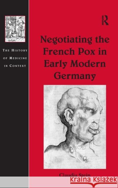 Negotiating the French Pox in Early Modern Germany Claudia Stein 9780754660088 ASHGATE PUBLISHING GROUP - książka