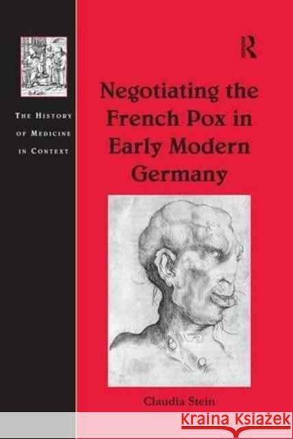 Negotiating the French Pox in Early Modern Germany Claudia Stein   9781138253230 Routledge - książka