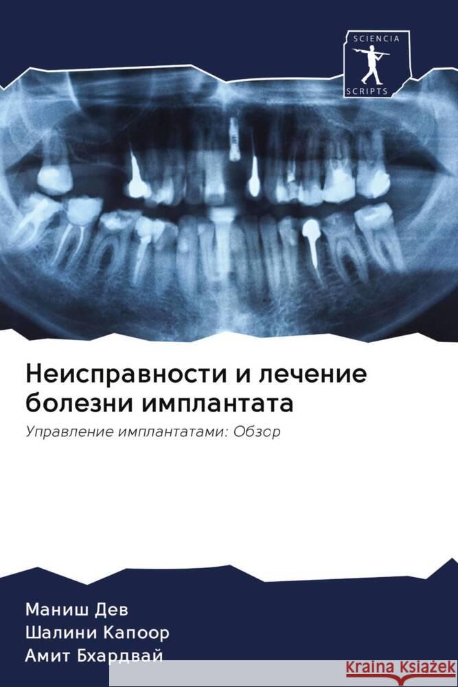 Neisprawnosti i lechenie bolezni implantata Dew, Manish, Kapoor, Shalini, Bhardwaj, Amit 9786203050837 Sciencia Scripts - książka