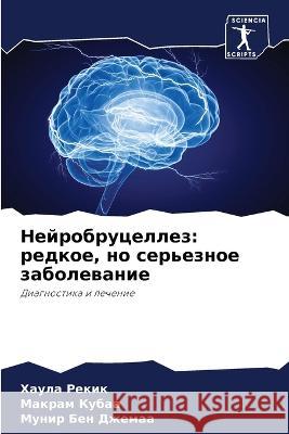 Nejrobrucellez: redkoe, no ser'eznoe zabolewanie Rekik, Haula, Kubaa, Makram, Ben Dzhemaa, Munir 9786205774595 Sciencia Scripts - książka