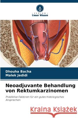 Neoadjuvante Behandlung von Rektumkarzinomen Bacha, Dhouha, Jedidi, Malek 9786208499136 Verlag Unser Wissen - książka