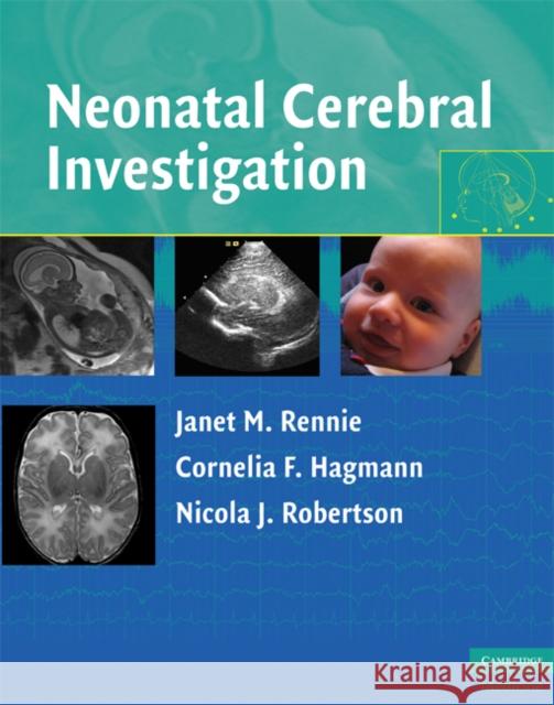 Neonatal Cerebral Investigation Janet M Rennie 9780521838481  - książka