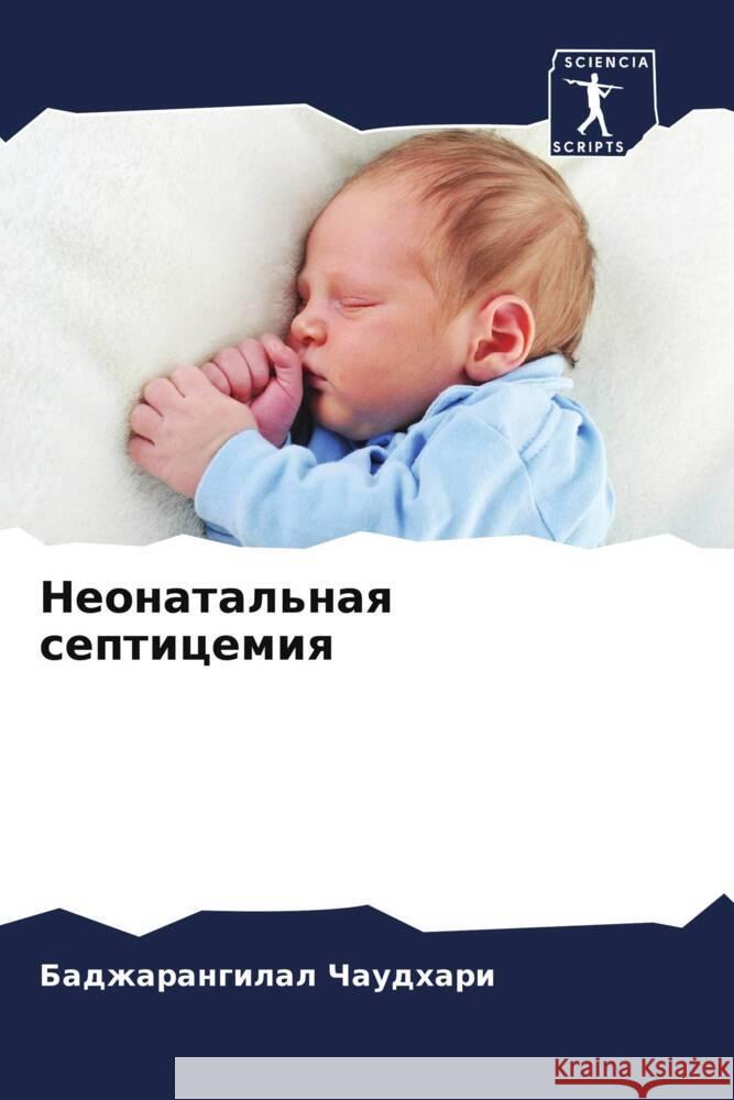 Neonatal'naq septicemiq Chaudhari, Badzharangilal 9786208585570 Sciencia Scripts - książka