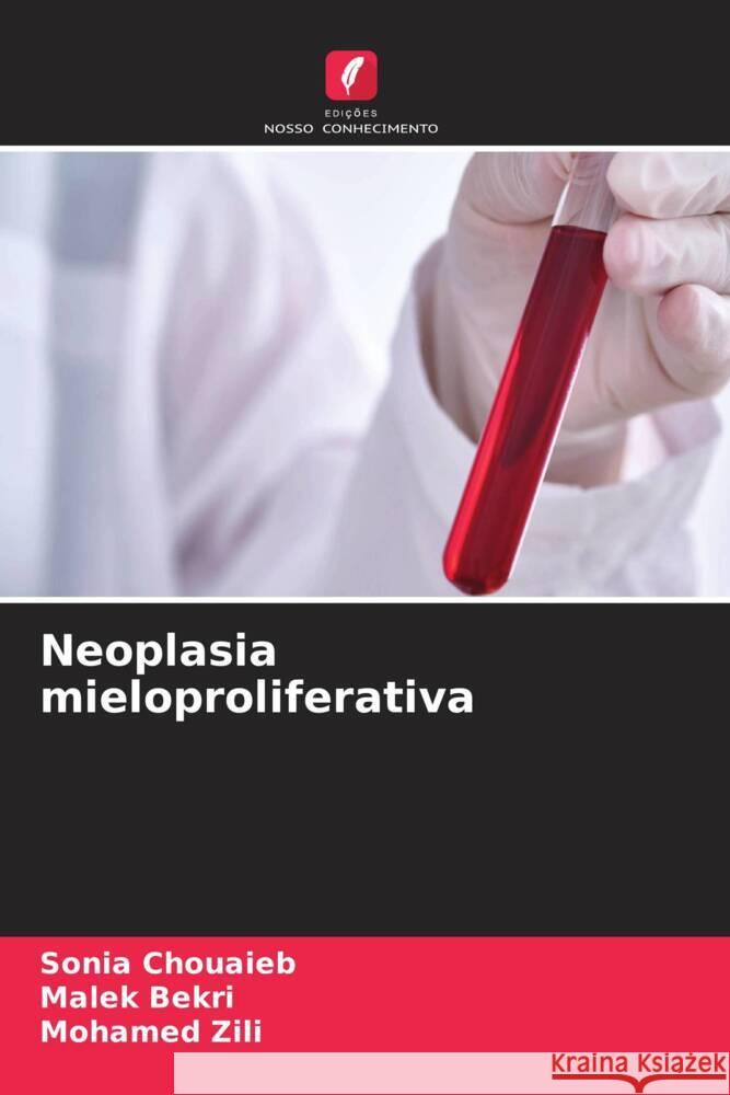 Neoplasia mieloproliferativa Chouaieb, Sonia, Bekri, Malek, Zili, Mohamed 9786206869979 Edições Nosso Conhecimento - książka