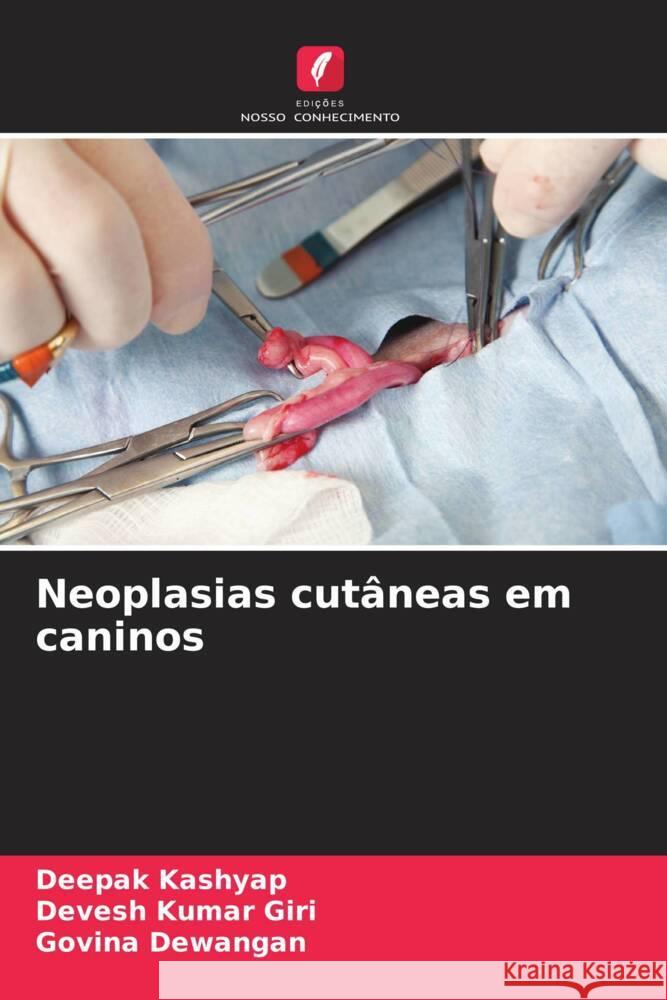 Neoplasias cutâneas em caninos Deepak Kashyap, Devesh Kumar Giri, Govina Dewangan 9786205376393 Edicoes Nosso Conhecimento - książka
