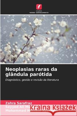 Neoplasias raras da gl?ndula par?tida Zahra Sarafraz Seyyed Ali Musavi Mohammad Hossein Azaraein 9786209201554 Edicoes Nosso Conhecimento - książka