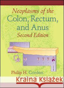 Neoplasms of the Colon, Rectum, and Anus Philip H. Gordon Santhat Nivatvongs Scott Thorn Barrows 9780824729592 Informa Healthcare - książka