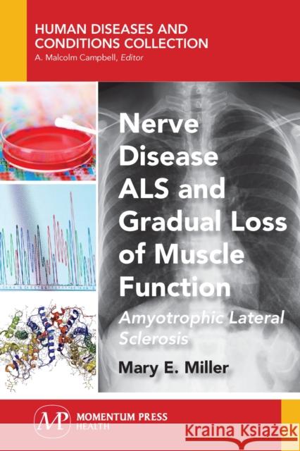 Nerve Disease ALS and Gradual Loss of Muscle Function: Amyotrophic Lateral Sclerosis Mary E. Miller 9781944749798 Momentum Press - książka