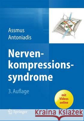 Nervenkompressionssyndrome Assmus, Hans 9783642552113 Springer - książka