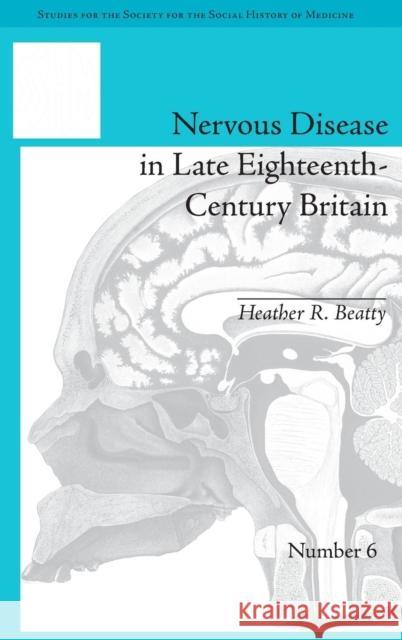 Nervous Disease in Late Eighteenth-Century Britain: The Reality of a Fashionable Disorder  9781848933088 Pickering & Chatto (Publishers) Ltd - książka