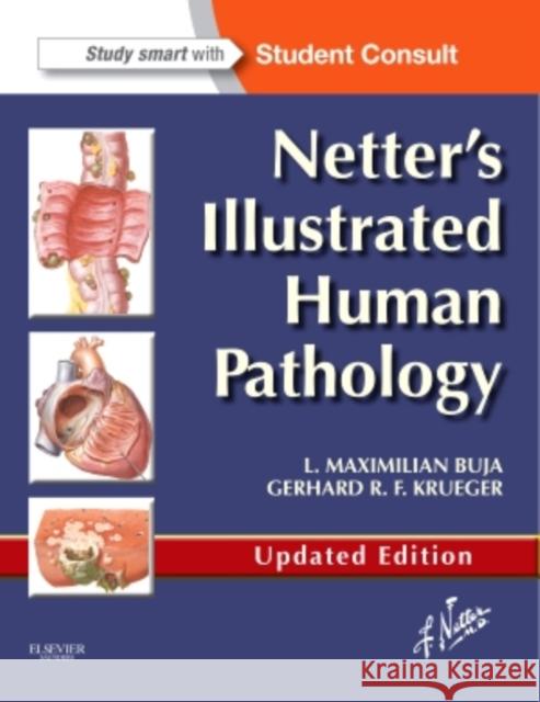 Netter's Illustrated Human Pathology Updated Edition: with Student Consult Access Gerhard R. F. (The University of Texas Health Science Center at Houston) Krueger 9780323220897 Elsevier - Health Sciences Division - książka