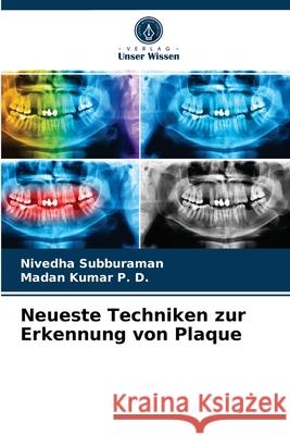 Neueste Techniken zur Erkennung von Plaque Nivedha Subburaman, Madan Kumar P D 9786203234527 Verlag Unser Wissen - książka