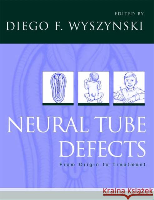 Neural Tube Defects: From Origin to Treatment Wyszynski, Diego F. 9780195166033  - książka