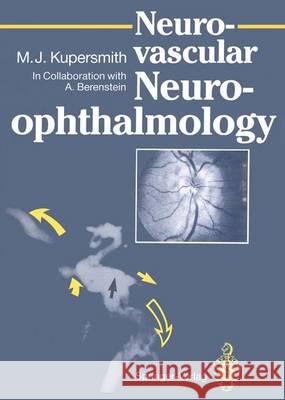 Neuro-vascular Neuro-ophthalmology Mark J. Kupersmith, A. Berenstein 9783642776229 Springer-Verlag Berlin and Heidelberg GmbH &  - książka