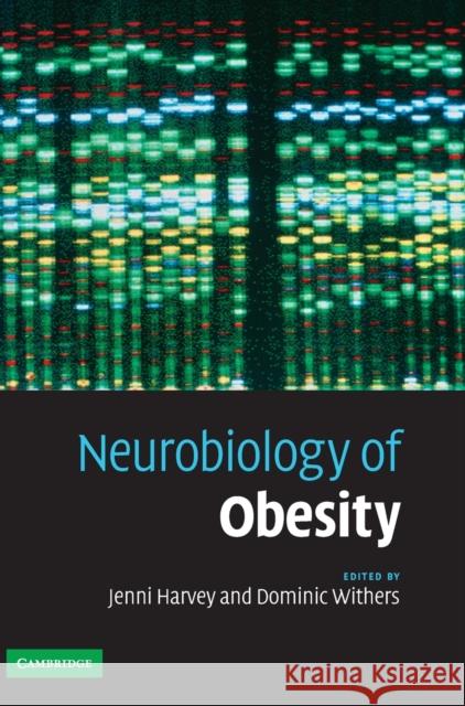 Neurobiology of Obesity Jenni Harvey Dominic Withers 9780521860338 Cambridge University Press - książka