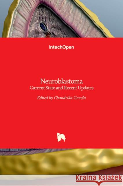 Neuroblastoma: Current State and Recent Updates Chandrika Gowda 9789535135838 Intechopen - książka