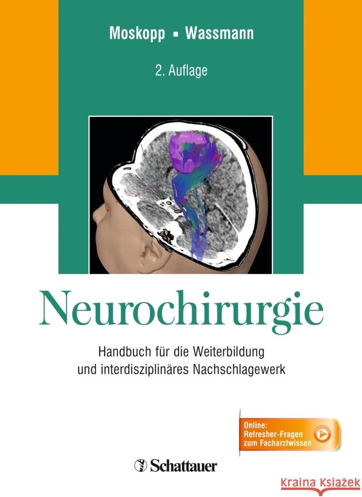 Neurochirurgie : Handbuch für die Weiterbildung und interdisziplinäres Nachschlagewerk Moskopp, Dag; Wassmann, Hansdetlef 9783132435797 Thieme, Stuttgart - książka