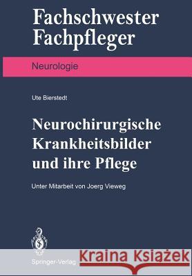 Neurochirurgische Krankheitsbilder Und Ihre Pflege Bierstedt, Ute 9783540521532 Not Avail - książka