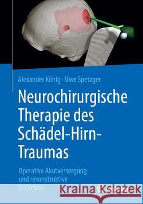 Neurochirurgische Therapie Des Schädel-Hirn-Traumas: Operative Akutversorgung Und Rekonstruktive Verfahren König, Alexander 9783662579275 Springer - książka