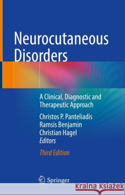 Neurocutaneous Disorders: A Clinical, Diagnostic and Therapeutic Approach Panteliadis, Christos P. 9783030878924 Springer International Publishing - książka