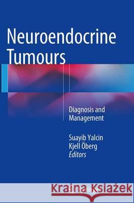 Neuroendocrine Tumours: Diagnosis and Management Yalcin, Suayib 9783662523599 Springer - książka