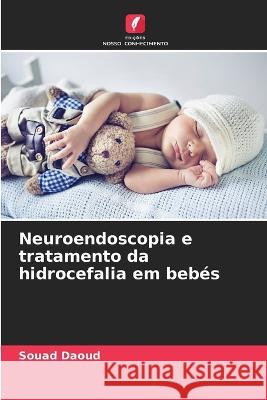 Neuroendoscopia e tratamento da hidrocefalia em beb?s Souad Daoud 9786205704790 Edicoes Nosso Conhecimento - książka