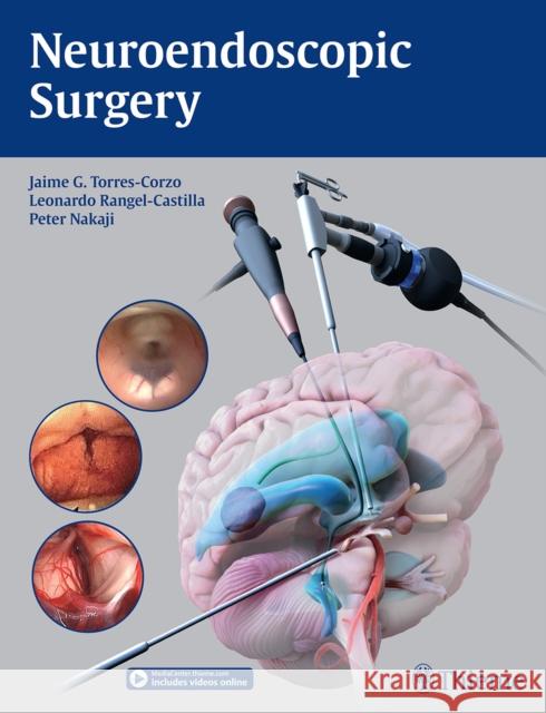 Neuroendoscopic Surgery Jaime Torres-Corzo Leonardo Rangel-Castilla Peter Nakaji 9781684202218 Thieme Medical Publishers Inc - książka