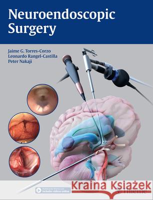 Neuroendoscopic Surgery : Includes videos online Jaime Torres-Corzo Leonardo Rangel-Castilla Peter Nakaji 9781626231610 Thieme Medical Publishers - książka