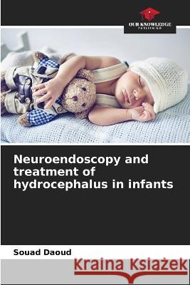 Neuroendoscopy and treatment of hydrocephalus in infants Souad Daoud 9786205704769 Our Knowledge Publishing - książka