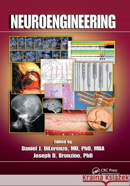 Neuroengineering Daniel J. Dilorenzo Joseph D. Bronzino 9780367388041 CRC Press - książka