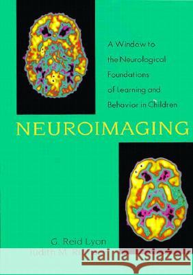 Neuroimaging: A Window to the Neurological Foundations of Learning and Behavior in Children G. Reid Lyon Judith M. Rumsey 9781557662569 Brookes Publishing Company - książka