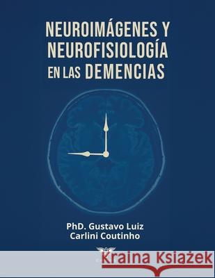 Neuroim?genes y neurofisiolog?a en las demencias Grupo ?gneo Gustavo Luiz Carlin 9786125170316 Caduceus - książka