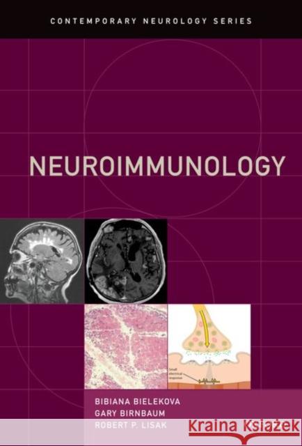 Neuroimmunology Bibiana Bielekova Gary Birnbaum Robert P. Lisak 9780190050801 Oxford University Press, USA - książka