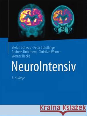 Neurointensiv Schwab, Stefan 9783662464991 Springer - książka