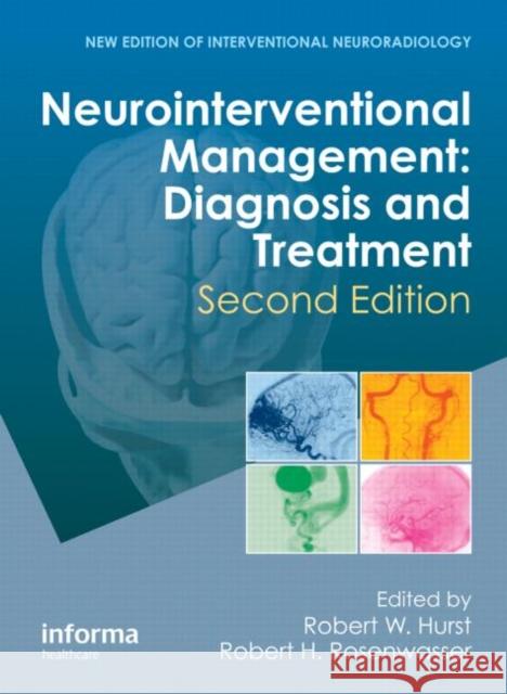 Neurointerventional Management: Diagnosis and Treatment, Second Edition Hurst, Robert W. 9781841848068 Informa Healthcare - książka