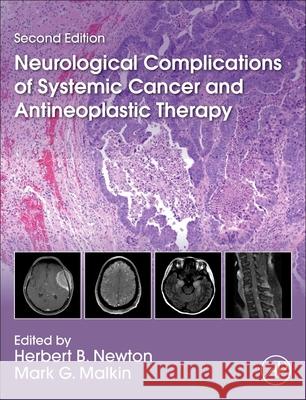 Neurological Complications of Systemic Cancer and Antineoplastic Therapy Herbert B. Newton Mark G. Malkin 9780128219768 Academic Press - książka