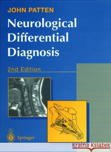 Neurological Differential Diagnosis John P Patten 9783540199373 Springer-Verlag Berlin and Heidelberg GmbH &  - książka