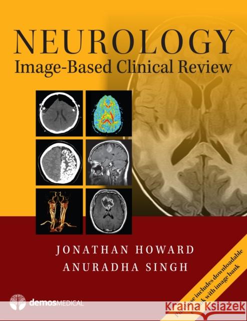 Neurology Image-Based Clinical Review Jonathan Howard Anuradha Singh 9781620701034 Demos Medical Publishing - książka