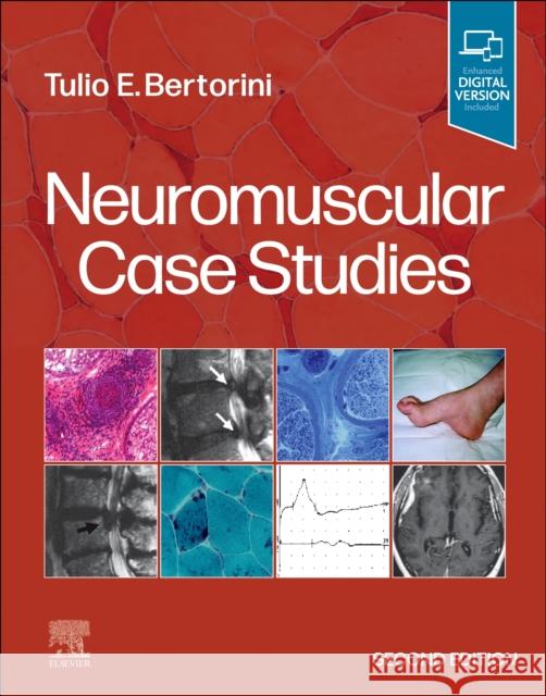 Neuromuscular Case Studies Tulio E. Bertorini 9780323874007 Elsevier - książka