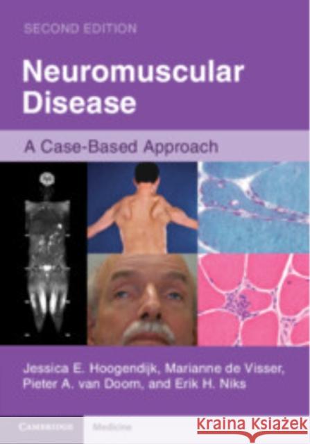 Neuromuscular Disease: A Case-Based Approach Erik H. (Leiden University Medical Center) Niks 9781108744188 Cambridge University Press - książka