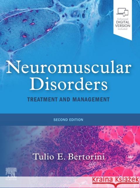 Neuromuscular Disorders: Treatment and Management Tulio E. Bertorini 9780323713177 Elsevier - książka