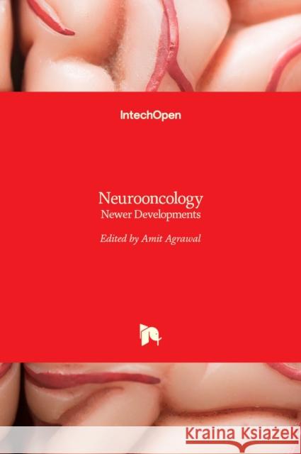 Neurooncology: Newer Developments Amit Agrawal 9789535124252 Intechopen - książka