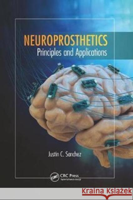 Neuroprosthetics: Principles and Applications Sanchez, Justin C. (University of Miami, Coral Gables, Florida, USA) 9781138749443 Rehabilitation Science in Practice Series - książka