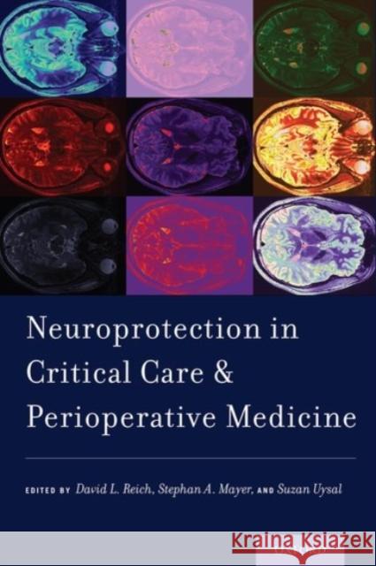 Neuroprotection in Critical Care and Perioperative Medicine David L. Reich Stephan A. Mayer Suzan Uysal 9780190280253 Oxford University Press, USA - książka